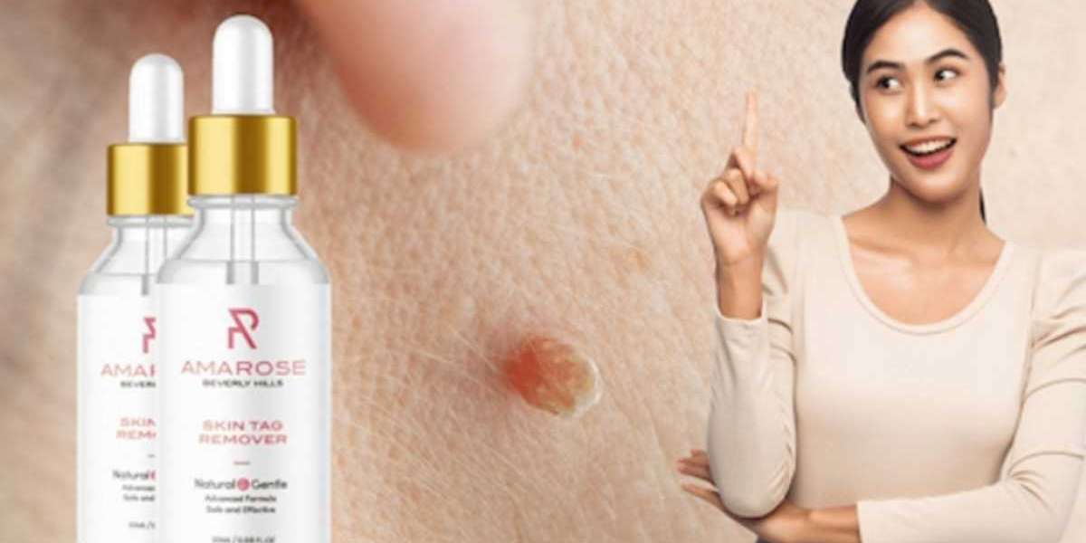 {Be #1 Scam}  Amarose Skin Tag Remover (2023) Don't Buy Before Read Real Price on Website!