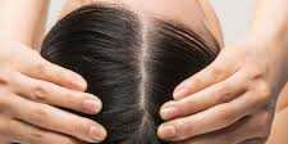 Expert Hair Loss Treatment in Long Island: A Comprehensive Guide