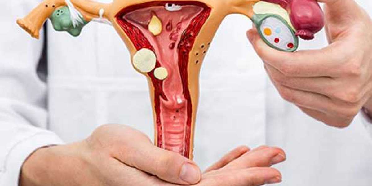 Gynecology Oncology Treatment in Jaipur: Specialized Care for Women