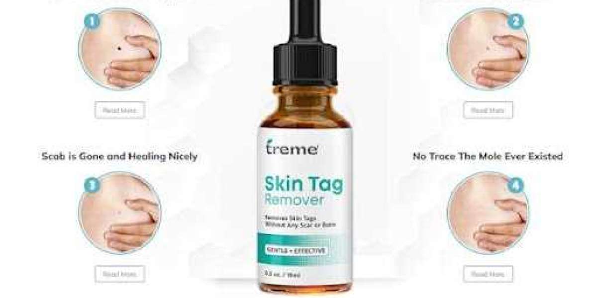 https://www.facebook.com/Treme.Skin.Tag.Remover.Official