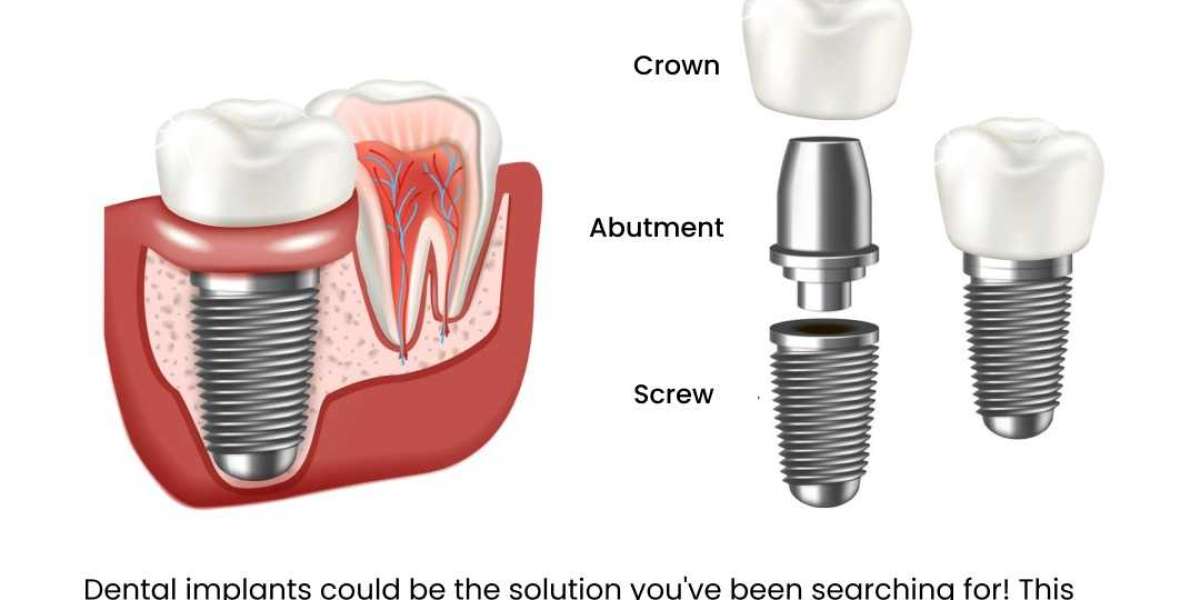 Transform Your Smile with the Best Implantologist in Bangalore: Expertise You Can Trust